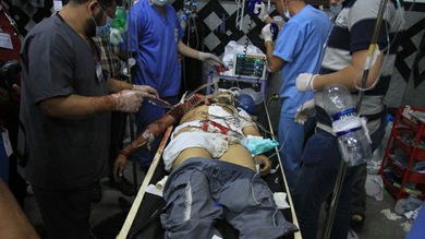 Manifestante herido: Foto: EFE