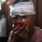 El Ministerio de Salud de Egipto eleva el número de heridos a 1.400 y confirma la cifra de 149 muertos.