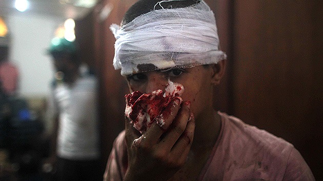 El Ministerio de Salud de Egipto eleva el número de heridos a 1.400 y confirma la cifra de 149 muertos.