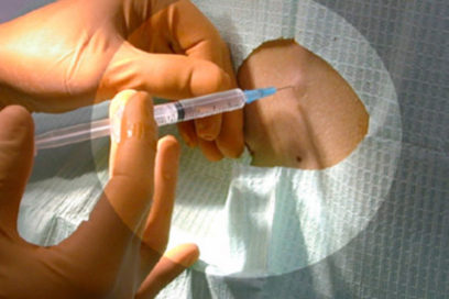 Security in Cuban Anesthesiology