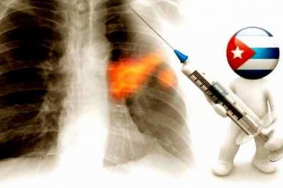Cuba podría haber encontrado cura contra el cáncer