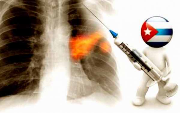 vacuna-cancer-pulmon