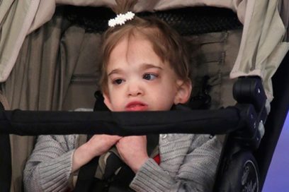 Muere en Estados Unidos el ‘bebé eterno’: una mujer de 20 años que no envejecía