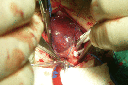 El valor de un corazón