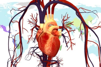 Mapamundi de enfermedades: De qué es más posible morir dependiendo de dónde se vive