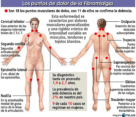 El gráfico presenta algunos de los puntos específicos en los que se presenta el dolor.
