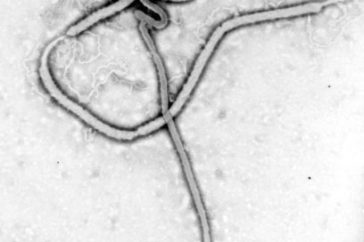 Preguntas frecuentes sobre la enfermedad por el virus del Ebola