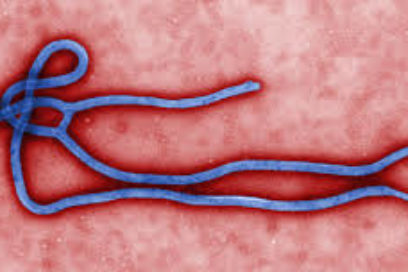 Frequent Questions on Ebola Viru
