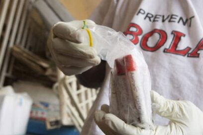 Aunar esfuerzos para contener al ébola