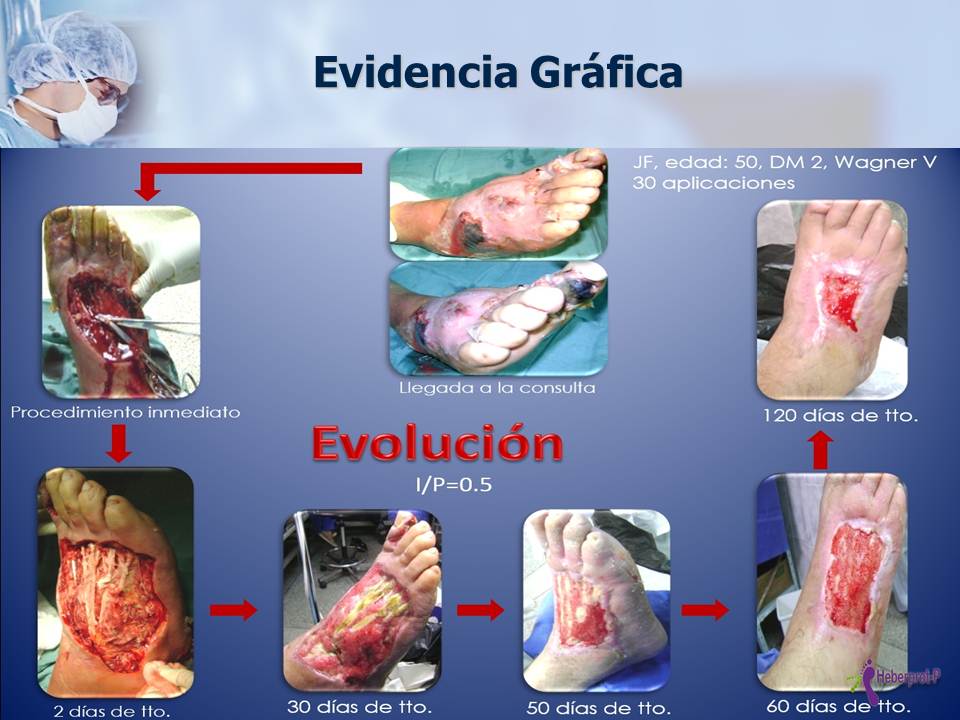 La consolidación del programa en Santiago de Cuba posibilita que más del 60 % de los pacientes evolucionen favorablemente.