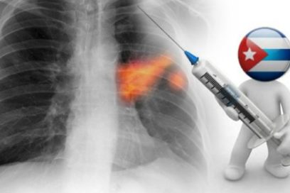 Derechos sí, humanos y cubanos