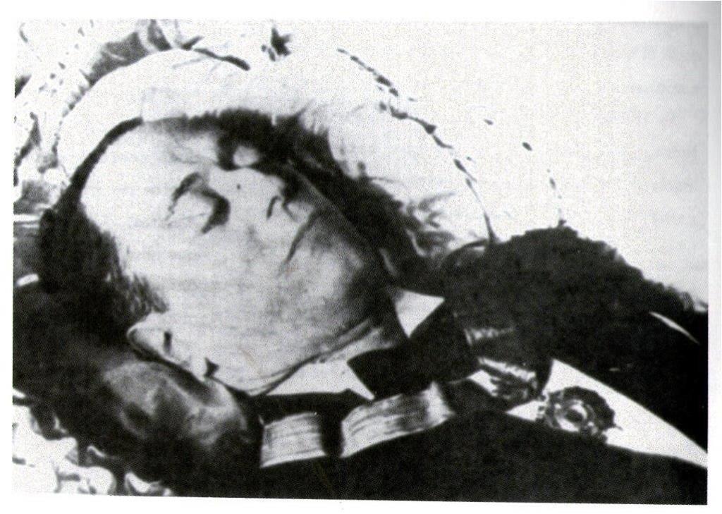 Cortesía del Doctor Manuel Hernández Meilán.