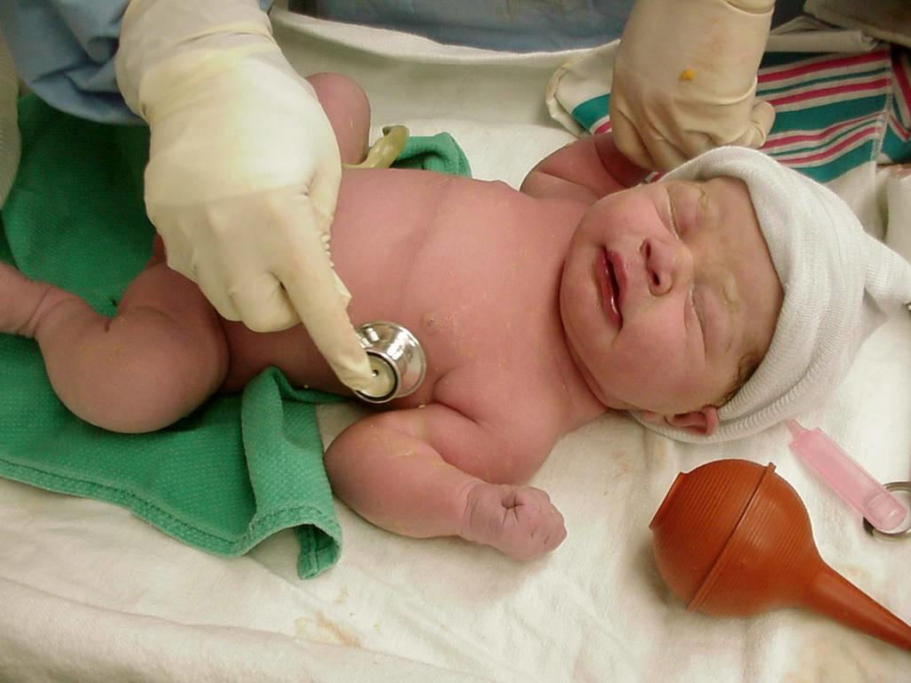 El Surfacen, eficaz en terapias para dificultades respiratorias del recién nacido, resulta también beneficioso para adultos con igual patología. Foto: Tomada de floridadecuba.wordpress.com