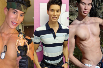 Plástico y circunstancia: Las variopintas motivaciones de la cirugía actual   