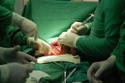 Cirugías in crescendo