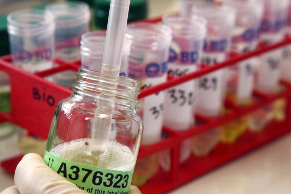 A picture taken at the French national anti-doping laboratory, on June 23 2008 in Chatenay-Malabry, outside Paris, shows a technician removing urine samples to be tested for EPO. Chatenay-Malabry laboratory will test next Tour de France edition's urine samples. AFP PHOTO JOEL SAGET (Photo credit should read JOEL SAGET/AFP/Getty Images)