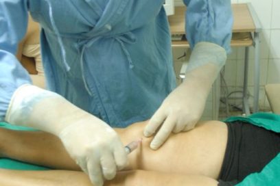 Células madre contra el dolor