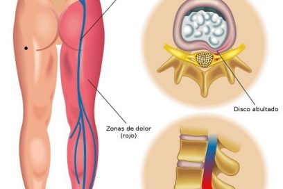 Un dolor que incapacita