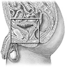 F050306 2