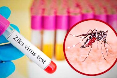 Diagnostican dos nuevos casos importados de Zika