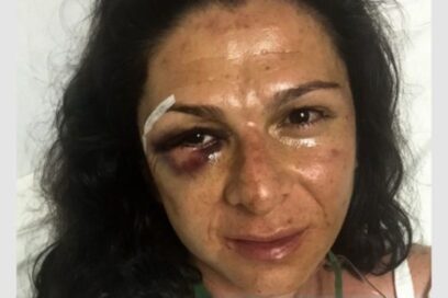 Ana Guevara: un caso más de violencia de género en México