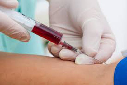 Sicklemia: Una enfermedad que pasa inadvertida