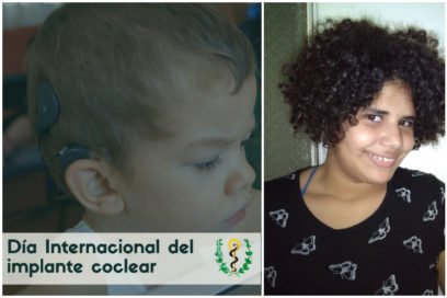 Cuba, 500th Hearing Cochlear Implant is Done
