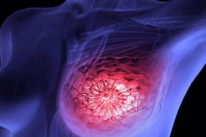 Examen de mama: Sin el peso de la duda (+ Fotos y PDF)