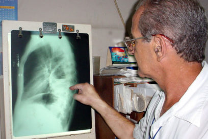 ¡Peligro! Gérmenes en tránsito