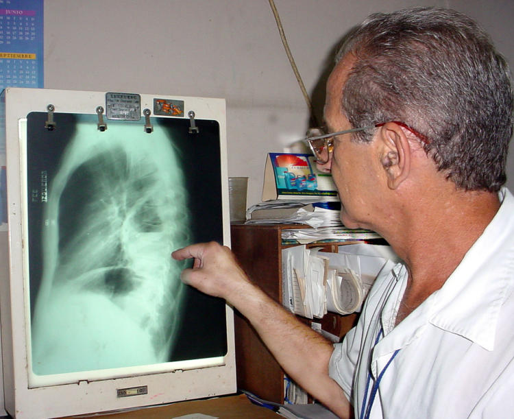 La confirmación del diagnóstico se realiza mediante estudios imagenológicos. Foto Jesus Martinez Perez