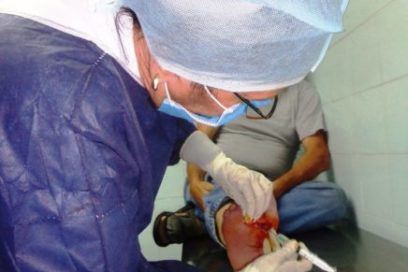 Tras las huellas del pie diabético en Venezuela (+Fotos)