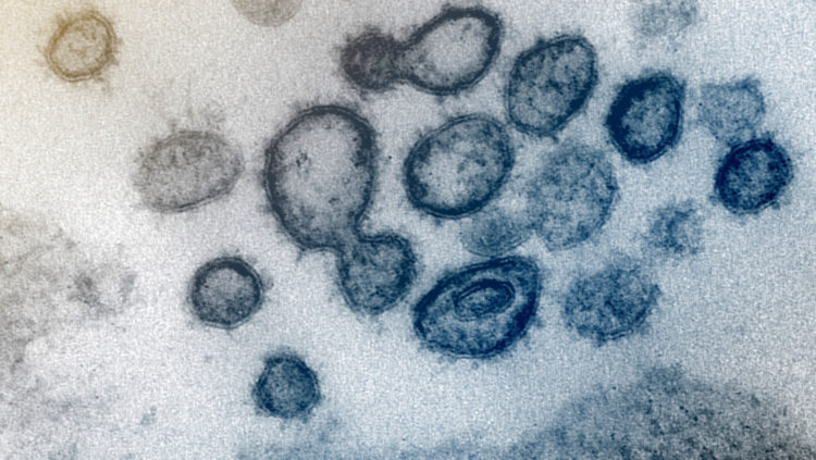El nuevo coronavirus SARS-CoV-2 bajo el microscopio (NIAID-RML / AP)