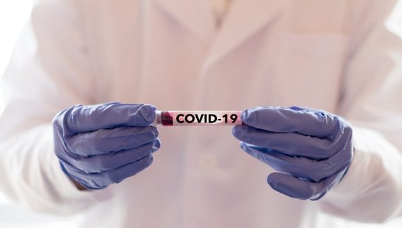 Laboratorios desarrollan vacuna contra el coronavirus. Foto: Gaceta Médica.