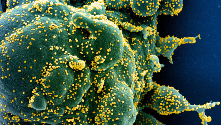 Representación gráfica por ordenador de una célula infectada de covid-19. (National Institute of Allergy and Infectious Diseases / Reuters)