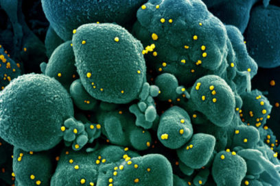 Covid-19: Mirada mundial (8 de mayo)