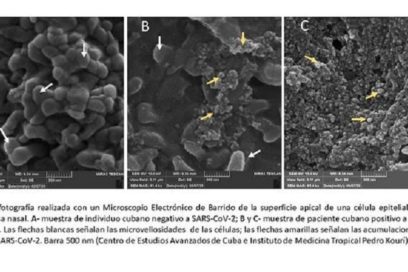 Científicos cubanos captan imagen del SARS-CoV-2 de muestras clínicas