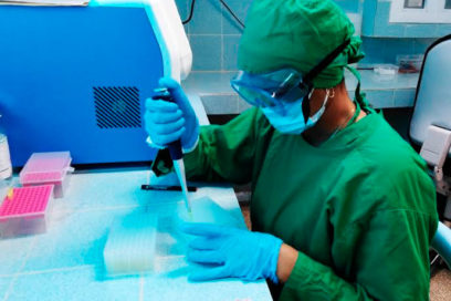 Bloqueo de Estados Unidos lacera la microbiología cubana