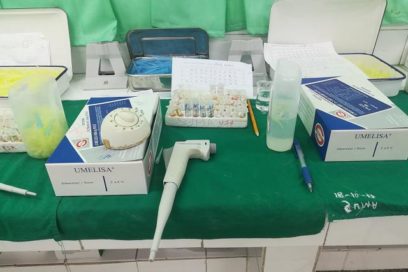 Umelisa SARS-COV-2 antígeno, un sistema de diagnóstico 100 % cubano (+Video)