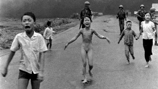La niña vietnamita Kim Puhc sufrió quemaduras provocadas por napalm y solo atinó a quitarse la ropa ante el dolor. Foto: AP