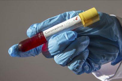 Cuidado, COVID-19 ¡apunta a un rebrote!