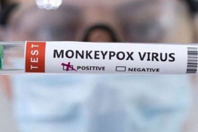 Diagnostican primer caso de viruela símica en Cuba