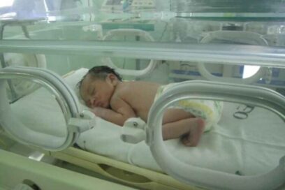 Unicef apoya servicios de neonatología cubanos