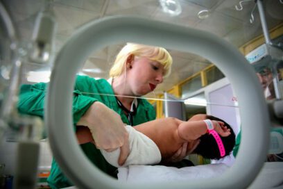 Generalizan  protocolo holguinero para atender a recién nacidos con atresia esofágica