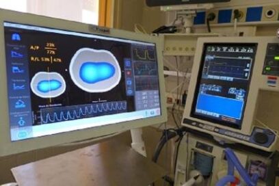 Un tomógrafo cubano en favor de las funciones respiratorias