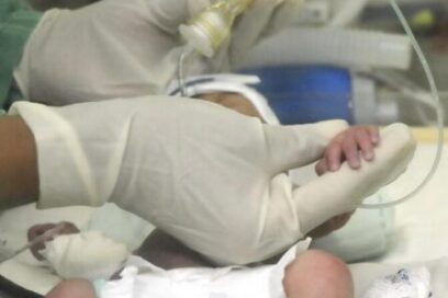 Aprueban registro para el diagnóstico neonatal con tecnología SUMA