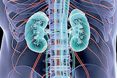 La enfermedad renal crónica puede descubrirse a tiempo