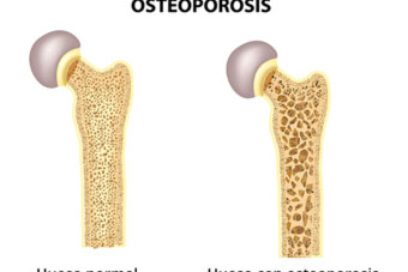 Muévete por tus huesos