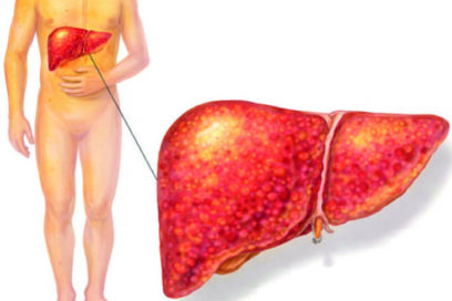 Protegerse contra las hepatitis